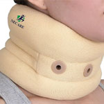 thumb-Spondylosis Hair Transplant